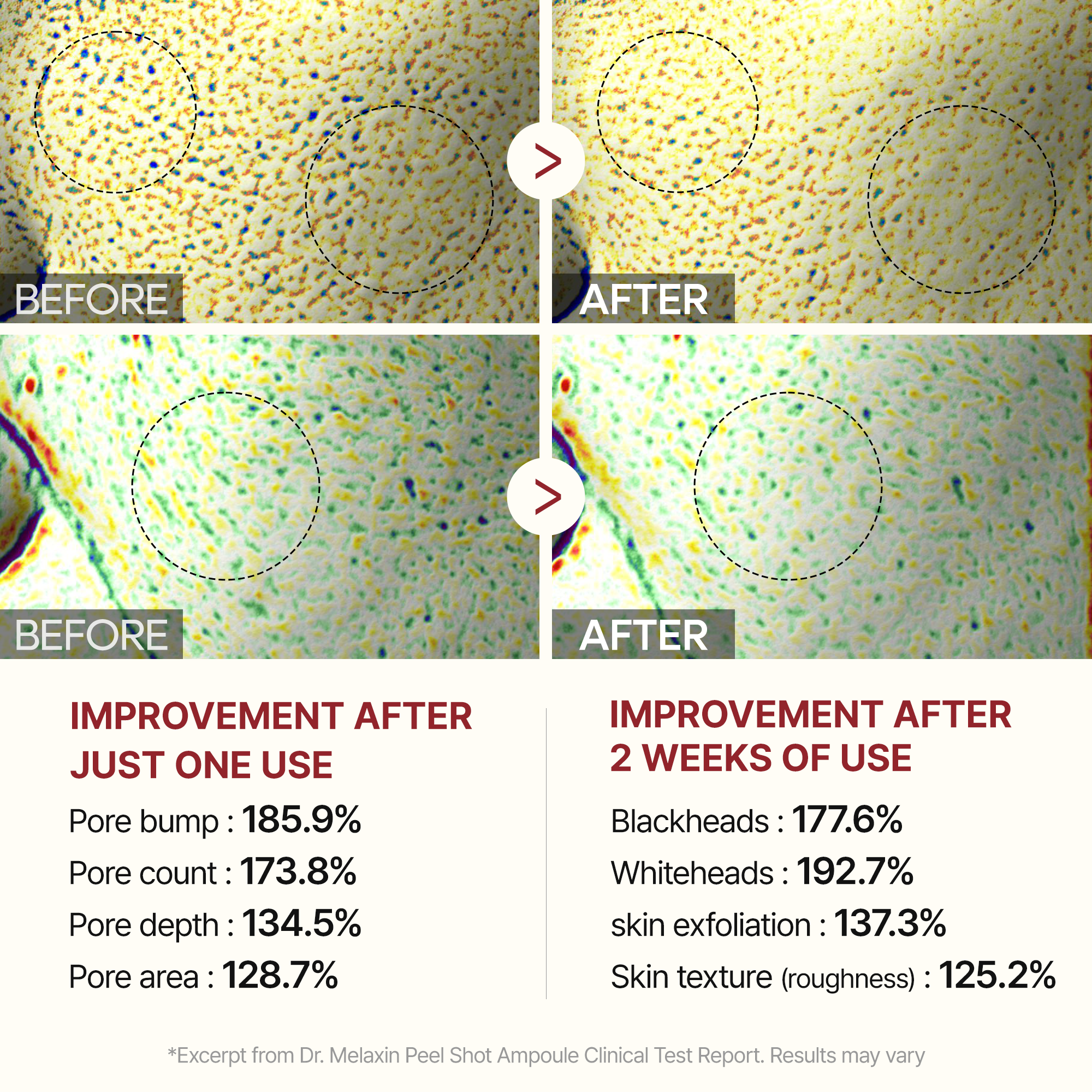 Peel Shot Glow Black Rice Ampoule